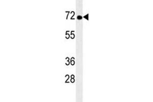 Image no. 2 for anti-Tyrosine Kinase, Non-Receptor, 1 (TNK1) antibody (ABIN3029413)