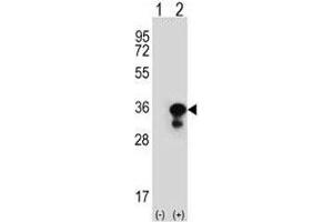 Image no. 5 for anti-Proliferating Cell Nuclear Antigen (PCNA) (AA 231-261) antibody (ABIN3032321)