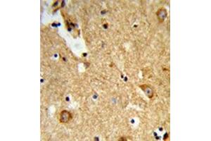 Image no. 2 for anti-Ectonucleoside Triphosphate diphosphohydrolase 2 (ENTPD2) (AA 92-122), (N-Term) antibody (ABIN952090)