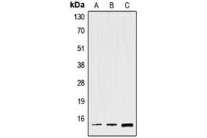 Image no. 1 for anti-Trefoil Factor 2 (TFF2) (Center) antibody (ABIN2707094)