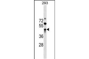 Image no. 1 for anti-Zinc Finger and BTB Domain Containing 32 (ZBTB32) (AA 96-125), (N-Term) antibody (ABIN5532282)