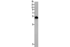 Image no. 2 for anti-BPI Fold Containing Family B, Member 2 (BPIFB2) antibody (ABIN2426145)