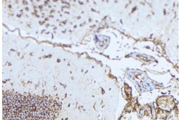 anti-Norrie Disease (Pseudoglioma) (NDP) antibody