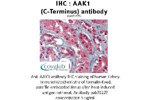 Image no. 2 for anti-AP2 associated kinase 1 (AAK1) (C-Term) antibody (ABIN1731398)