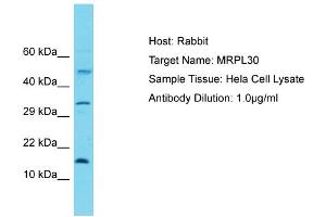 anti-Mitochondrial Ribosomal Protein L30 (MRPL30) (C-Term) antibody