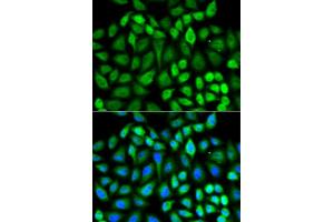 Image no. 15 for anti-Mitogen-Activated Protein Kinase 3 (MAPK3) (N-Term) antibody (ABIN3020725)