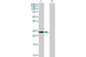 Image no. 2 for anti-Methyltransferase Like 11A (METTL11A) (AA 1-223) antibody (ABIN526046)