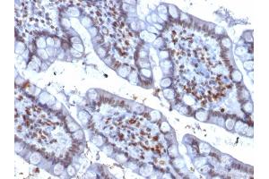 Image no. 4 for anti-Spleen Focus Forming Virus (SFFV) Proviral Integration Oncogene Spi1 (SPI1) (AA 16-170) antibody (ABIN6940631)