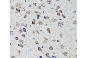 Immunohistochemistry of paraffin-embedded Rat brain using HEXA Polyclonal Antibody at dilution of 1:100 (40x lens).