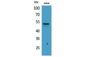 Image no. 2 for anti-alpha Tubulin (TUBA1) (acLys40) antibody (ABIN3181895)