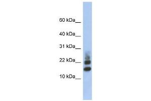 anti-Ribosomal Protein S15a (RA) (Middle Region) antibody
