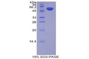Image no. 1 for Pregnancy Zone Protein (PZP) (AA 1251-1500) protein (His tag,GST tag) (ABIN1877862)