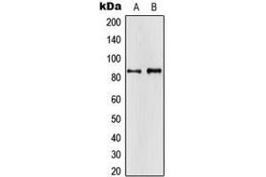 Image no. 2 for anti-Amyloid beta (A4) Precursor Protein-Binding, Family A, Member 2 (APBA2) (Center) antibody (ABIN2705479)