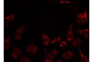 Image no. 2 for anti-Mitochondrial Ribosomal Protein L51 (MRPL51) (C-Term) antibody (ABIN6258523)