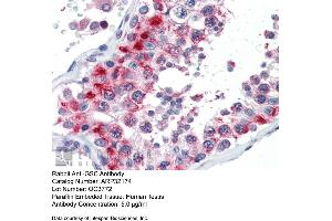 Image no. 3 for anti-Goosecoid Homeobox (GSC) (N-Term) antibody (ABIN2779490)