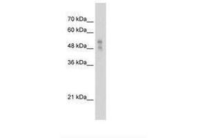Image no. 2 for anti-Purinergic Receptor P2X, Ligand Gated Ion Channel 1 (P2RX1) (AA 252-301) antibody (ABIN203326)