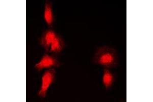 Image no. 2 for anti-Histone Deacetylase 7 (HDAC7) (N-Term), (pSer155) antibody (KLH) (ABIN2972853)