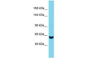 Image no. 1 for anti-Tensin 3 (TNS3) (C-Term) antibody (ABIN2790595)