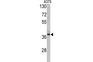 Image no. 1 for anti-Transaldolase 1 (TALDO1) antibody (ABIN3002744)