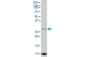 Image no. 1 for anti-JAZF Zinc Finger 1 (JAZF1) (AA 165-243) antibody (ABIN566957)