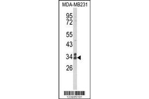 Image no. 1 for anti-Clathrin, Light Chain A (CLTA) (AA 99-127) antibody (ABIN652956)