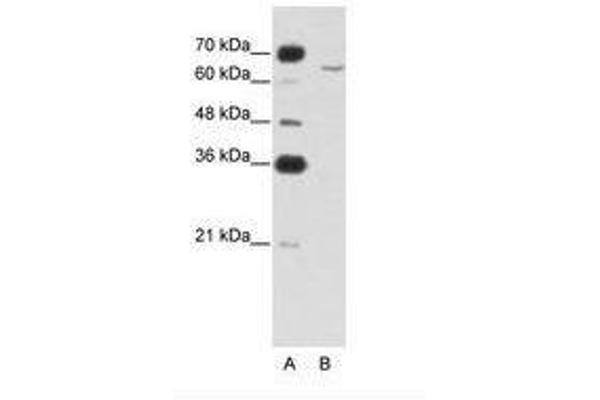 CPEB2 抗体  (AA 543-592)