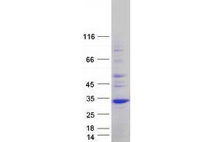 Image no. 1 for Unc-119 Homolog (UNC119) (Transcript Variant 2) protein (Myc-DYKDDDDK Tag) (ABIN2735012)
