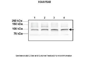Image no. 2 for anti-KIAA1549 (KIAA1549) (C-Term) antibody (ABIN2783140)
