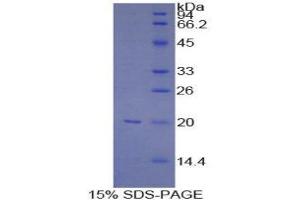 Image no. 1 for Baculoviral IAP Repeat-Containing 5 (BIRC5) (AA 1-142) protein (His tag) (ABIN1099490)