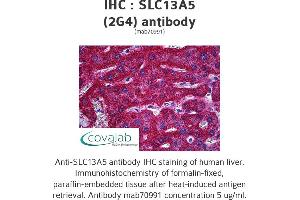 Image no. 1 for anti-Solute Carrier Family 13 Member 5 (SLC13A5) (AA 152-207) antibody (ABIN1723840)