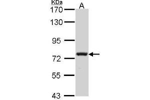 Image no. 3 for anti-Calpain 5 (CAPN5) (N-Term) antibody (ABIN2856595)