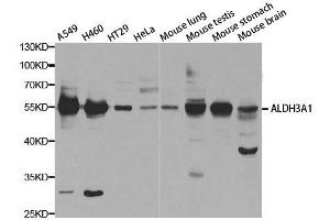 Image no. 1 for anti-Aldehyde Dehydrogenase 3 Family, Member A1 (ALDH3A1) antibody (ABIN6136772)