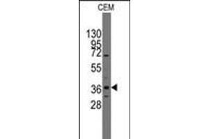 Image no. 2 for anti-Paired-Like Homeodomain 2 (PITX2) (AA 122-151) antibody (ABIN5537325)