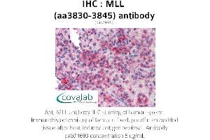 Image no. 1 for anti-Myeloid/lymphoid Or Mixed-Lineage Leukemia (MLL) (AA 3830-3845) antibody (ABIN1736978)