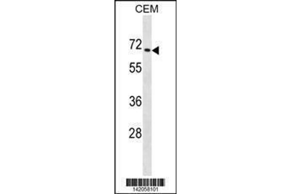 anti-Zinc Finger Protein 93 (ZNF93) (AA 40-67), (N-Term) antibody