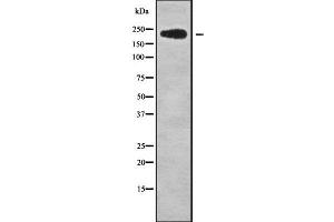 Western blot analysis NUP214 using LOVO whole cell lysates