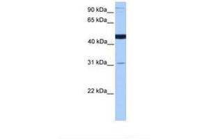 Image no. 1 for anti-Saccharopine Dehydrogenase (SCCPDH) (AA 316-365) antibody (ABIN6738887)
