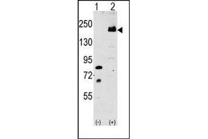 Image no. 1 for anti-Low Density Lipoprotein Receptor-Related Protein 6 (LRP6) (C-Term) antibody (ABIN358636)