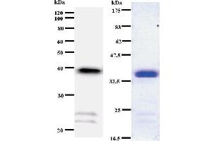 Image no. 1 for anti-Retinoic Acid Receptor, gamma (RARG) antibody (ABIN930976)