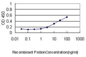 Image no. 1 for anti-Calsequestrin 2 (CASQ2) (AA 20-399) antibody (ABIN560181)