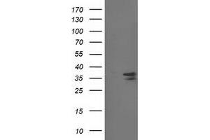 Image no. 1 for anti-Cyclin-Dependent Kinase 2 (CDK2) antibody (ABIN1497399)