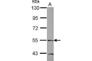 Image no. 1 for anti-TEA Domain Family Member 4 (TEAD4) (Center) antibody (ABIN2856634)