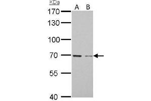 Image no. 1 for anti-Growth Arrest-Specific 6 (GAS6) (Center) antibody (ABIN2856080)