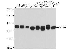 Image no. 3 for anti-Glyceraldehyde-3-Phosphate Dehydrogenase (GAPDH) antibody (ABIN3020541)