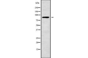 NUP88 Antikörper  (Internal Region)