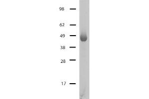 Image no. 1 for Histone Deacetylase 4 (HDAC4) (AA 645-1057), (Catalytic Domain) (Active) protein (ABIN2669629)