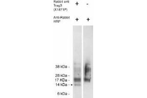 Image no. 1 for anti-CSAG Family, Member 2 (CSAG2) antibody (ABIN265186)