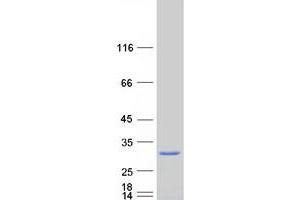 Image no. 1 for Melanoregulin (MREG) protein (Myc-DYKDDDDK Tag) (ABIN2725811)