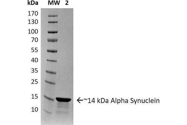 SNCA Protein (full length)