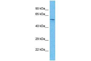 Image no. 1 for anti-SIX Homeobox 4 (SIX4) (Middle Region) antibody (ABIN2779626)